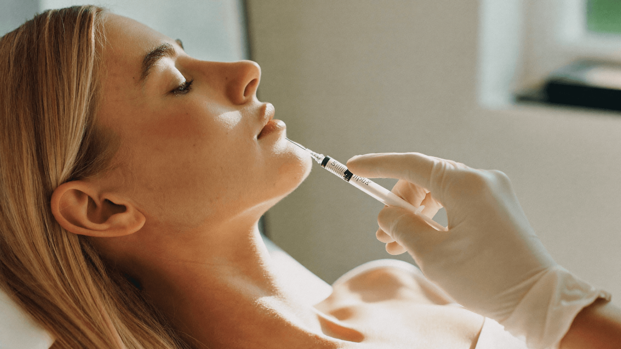 Filler migration: what it is and how we correct it